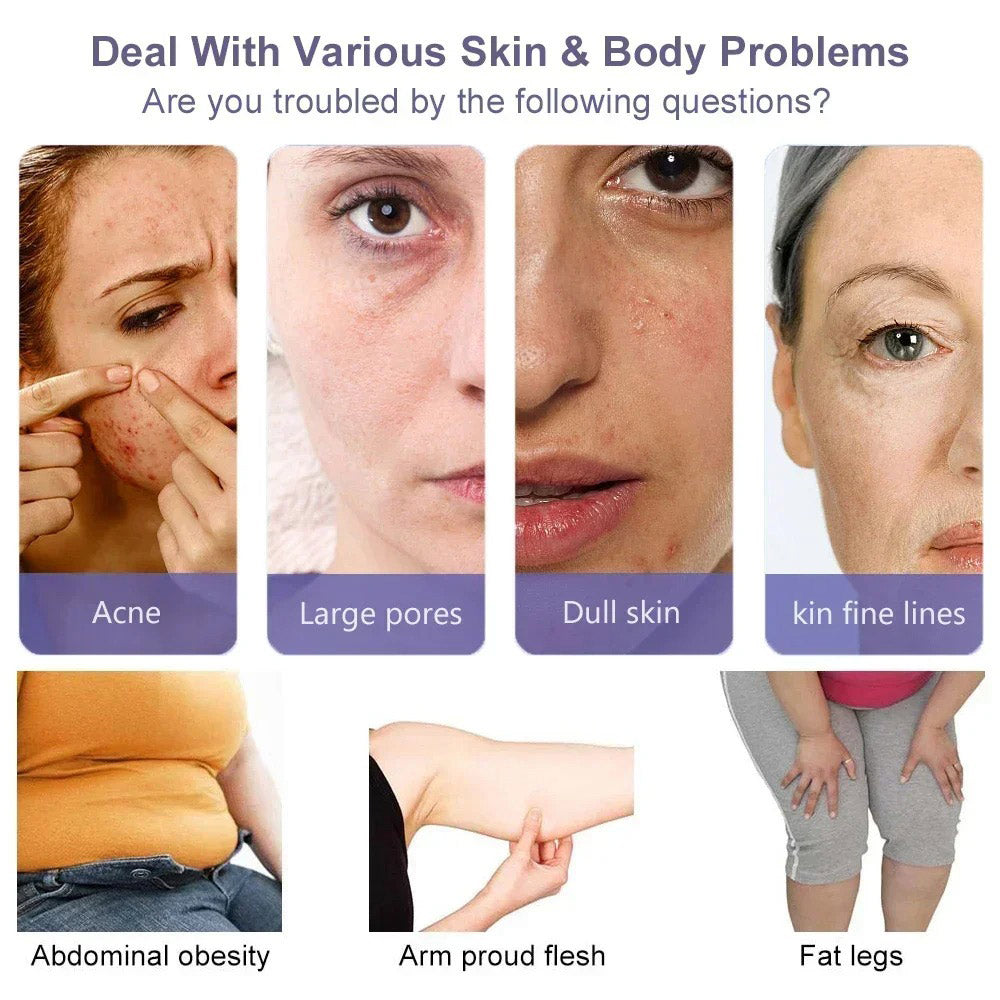 4 in 1 HIFU RF EMS Anti Wrinkle Device