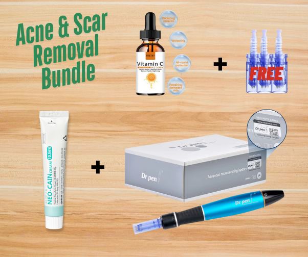 Acne scars Treatment deal