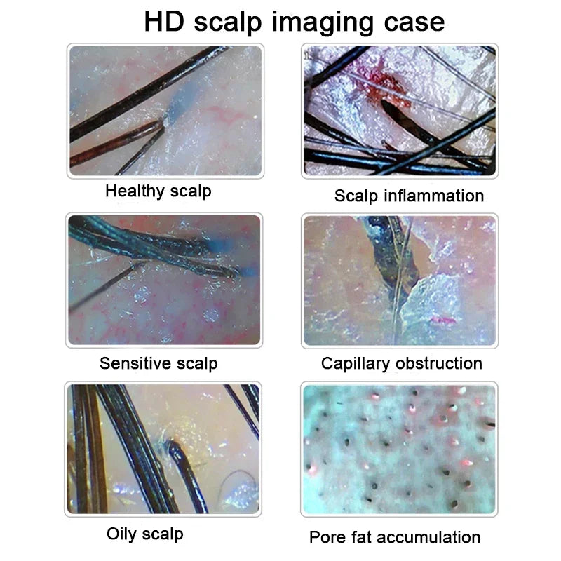 Hair & Skin Analysis Machine | Professional HD Scalp Scanner Detector