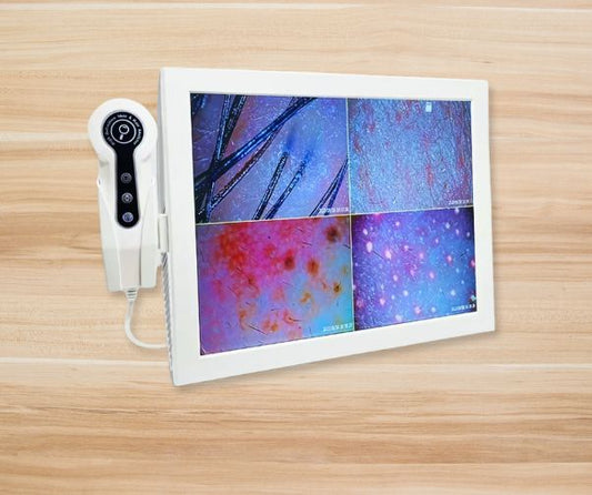 Hair & Skin Analysis Machine | Professional HD Scalp Scanner Detector