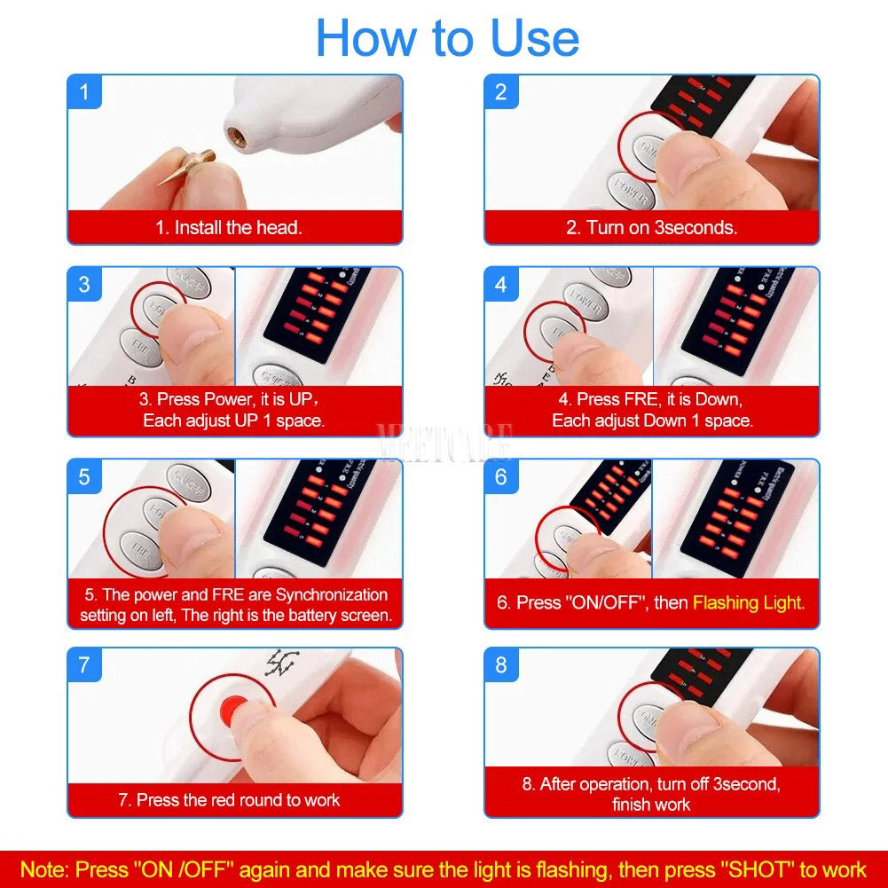 Professional Mole Pen, Tatto Wart Remover Device with Premium Box