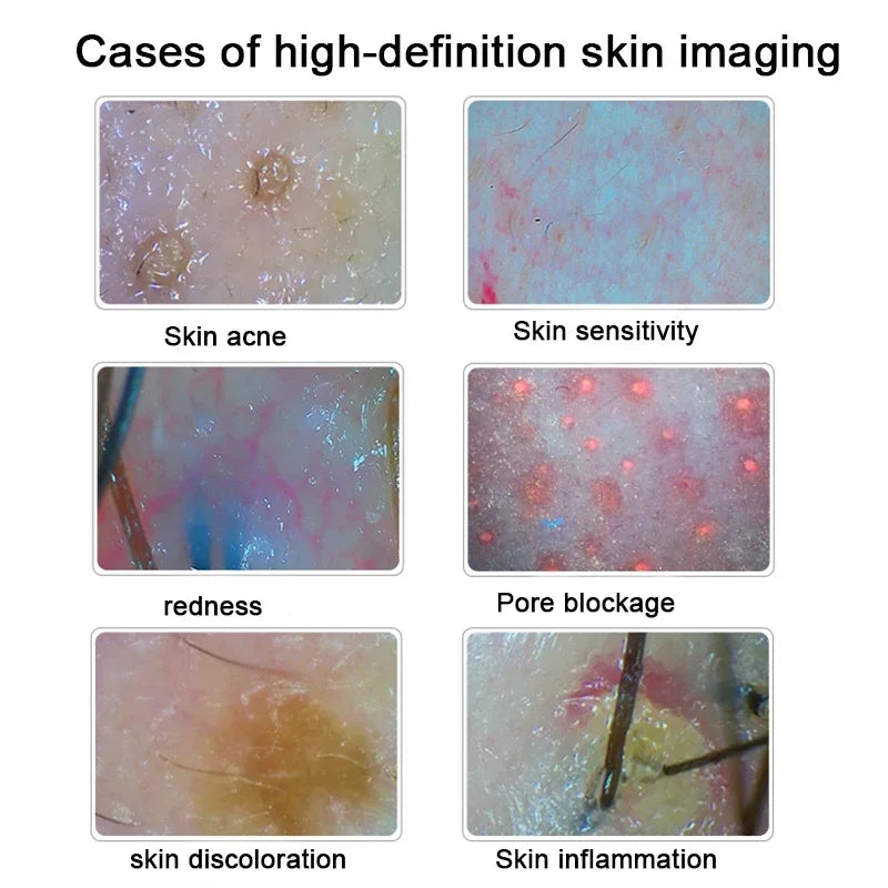 Hair & Skin Analysis Machine | Professional HD Scalp Scanner Detector