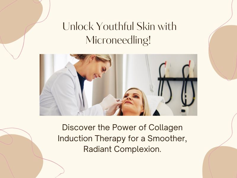 Microneedling: The Skin Rejuvenation Treatment You Need to Know About