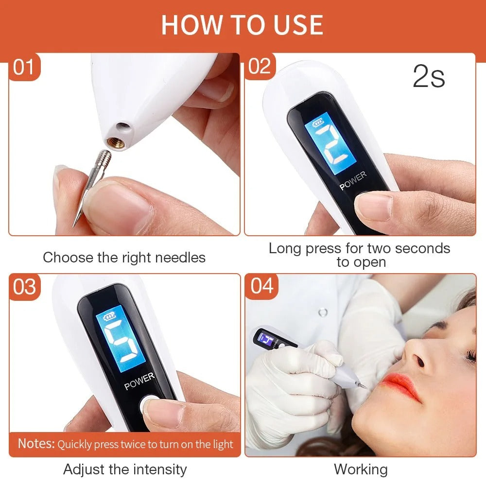 Mole Remover Plasma Pen – Spot, Mole & Skin Tag Removal Device