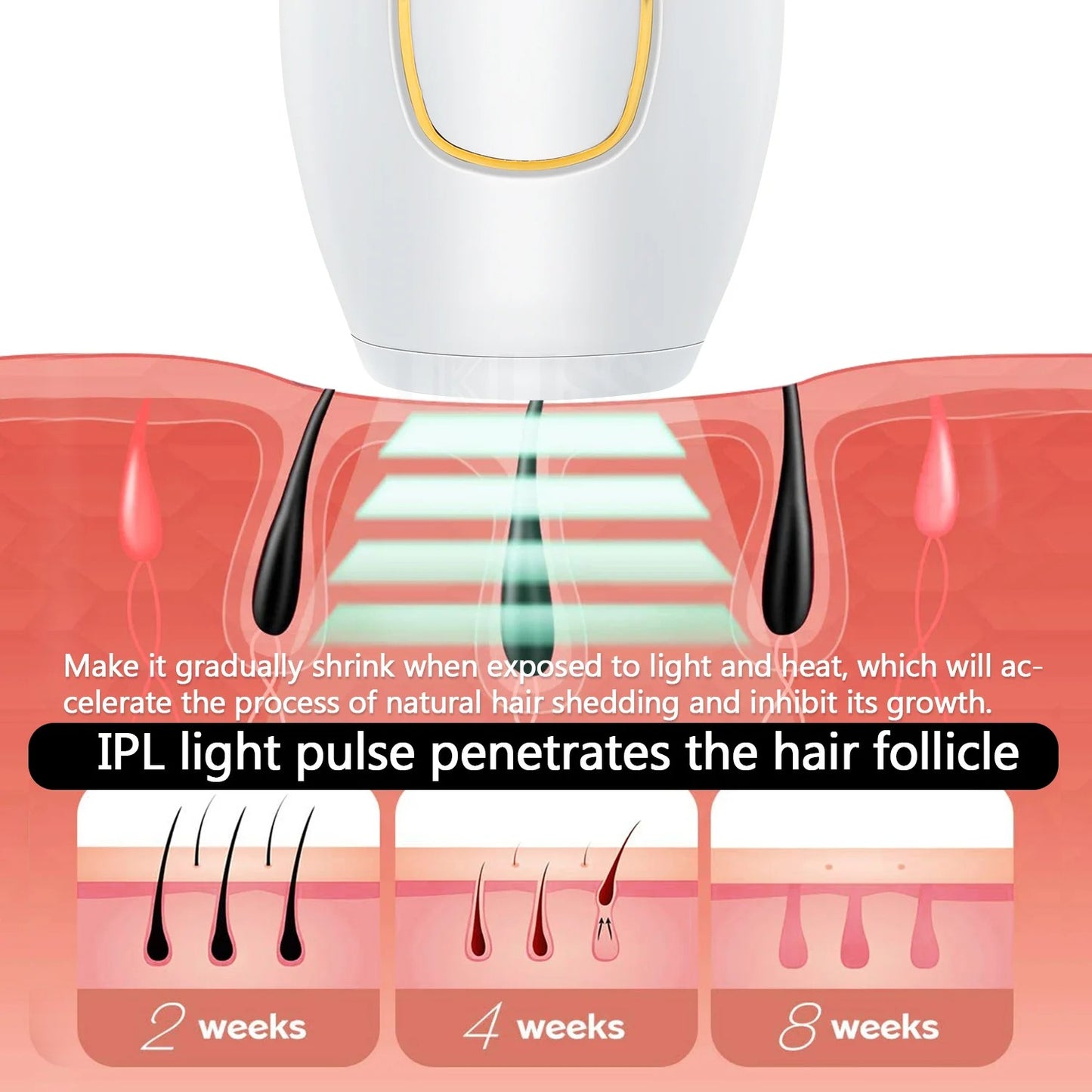 IPL Hair Removal Device in Pakistan