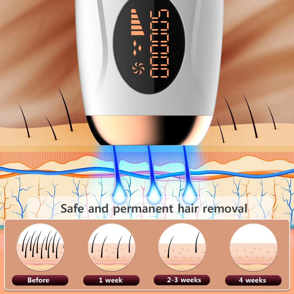 Best Laser Hair Removal Machine with 999990 Flashes