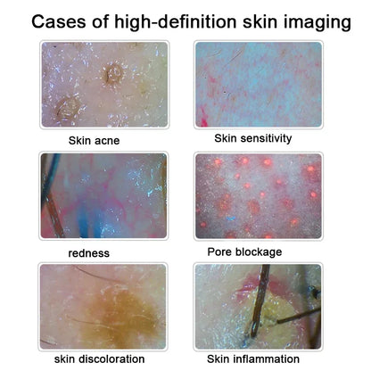 Hair & Skin Analysis Machine | Professional HD Scalp Scanner Detector