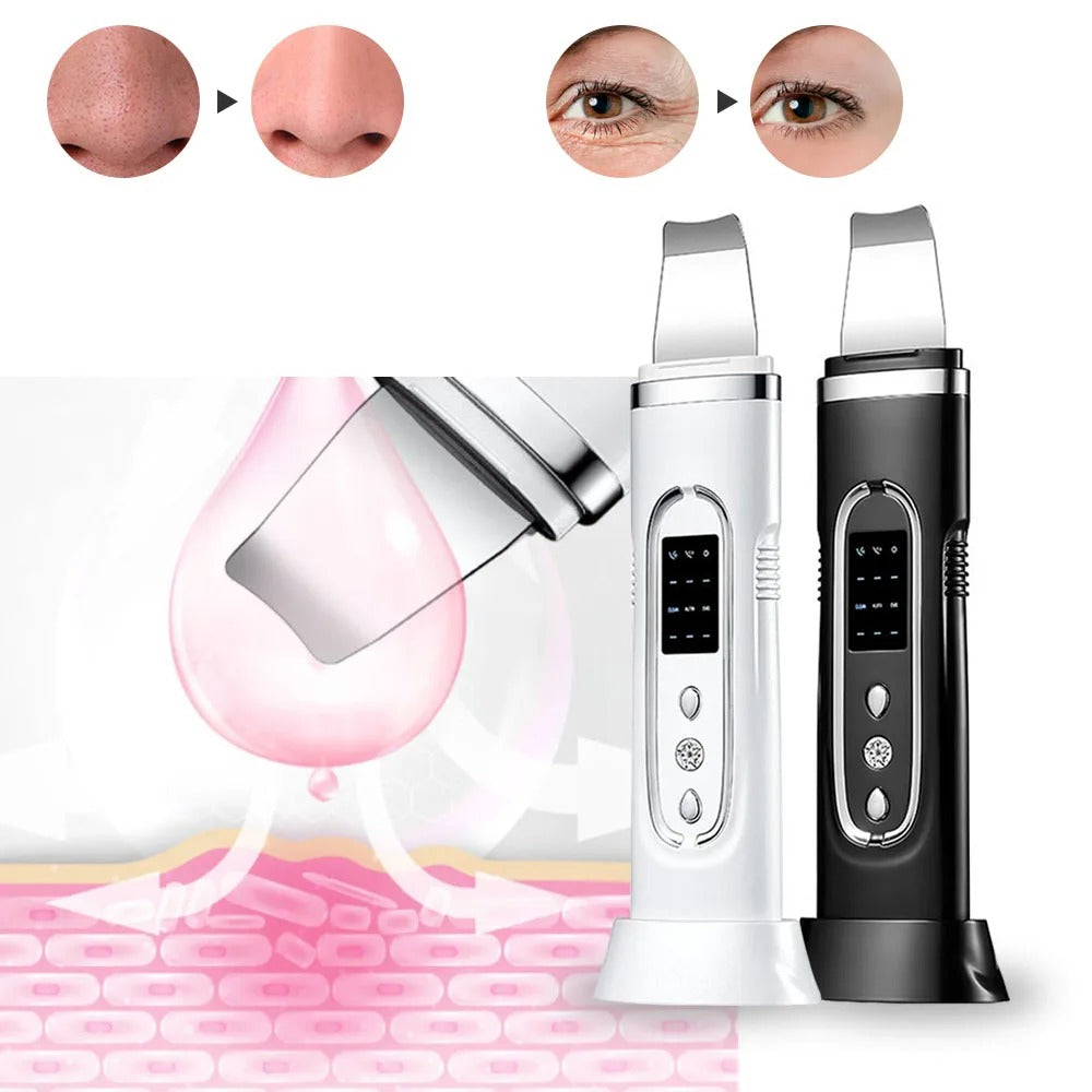 Ultrasonic Skin Cleaner Facial Scrubber – Deep Pore Cleansing & Blackhead Remover
